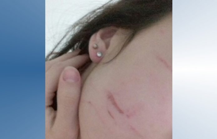 agressão ok