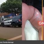 Bebê de 8 meses sofre queimaduras graves durante banho em creche de Sarandi