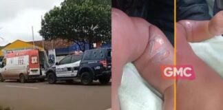Bebê de 8 meses sofre queimaduras graves durante banho em creche de Sarandi