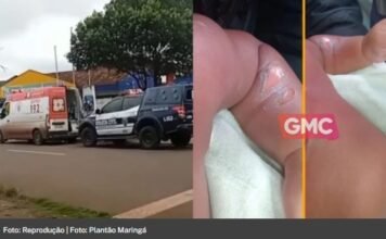 Bebê de 8 meses sofre queimaduras graves durante banho em creche de Sarandi