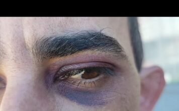 André Amaral traz mais detalhes do caso violento de Kaloré. Autor foi preso